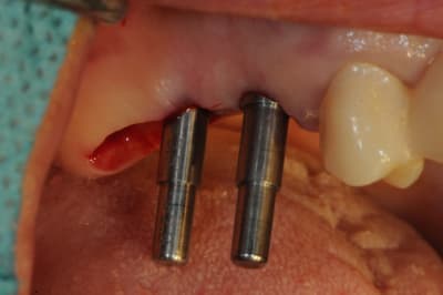 Dsc 3564 rvh08i - Eugenol