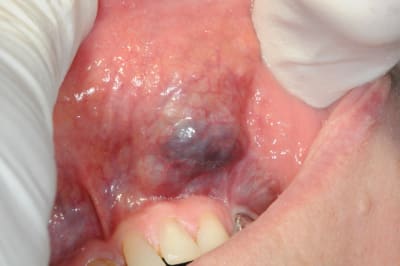 Dsc 3882 ecgxha - Eugenol