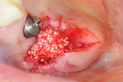 Dsc 3882 phnjzg - Eugenol