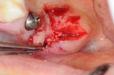 Dsc 3886 ew7rau - Eugenol