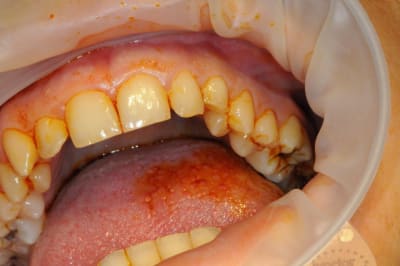 Dsc 3936 zkhnrg - Eugenol