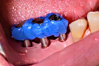 Dsc 4057 f6clao - Eugenol