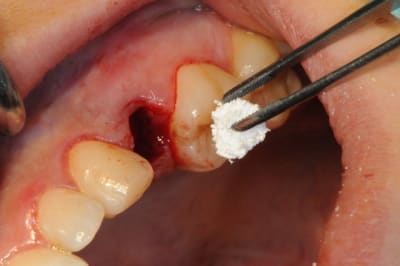 Dsc 4089 glvhze - Eugenol