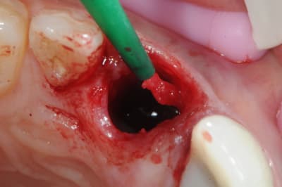 Dsc 4262 frqnjt - Eugenol