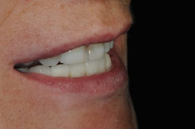 Dsc 4394 lbfiwn - Eugenol