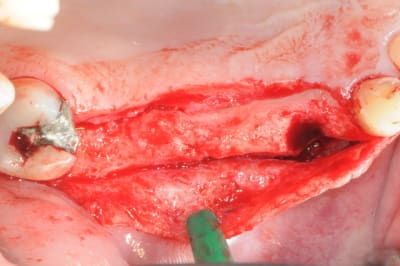 Dsc 4552 reccgv - Eugenol