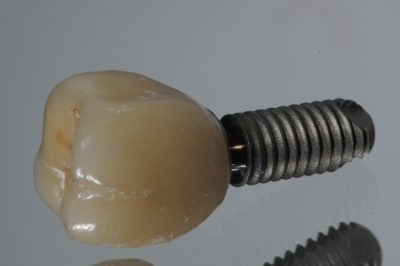 Dsc 4631 wyt3e6 - Eugenol
