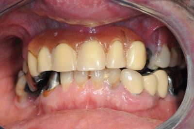 Dsc 4695 bvm9i3 - Eugenol