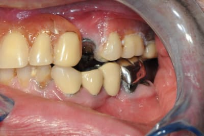 Dsc 4697 su6mtb - Eugenol