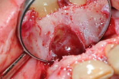 Dsc 5003 gjuyxf - Eugenol