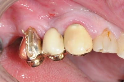 Dsc 5071 xmiig3 - Eugenol