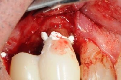 Dsc 5089 hlrhkc - Eugenol