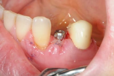Dsc 5166 fetsbg - Eugenol