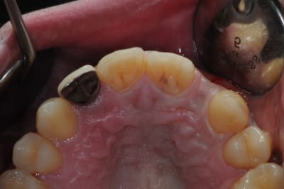 Dsc 5177 d6xuik - Eugenol