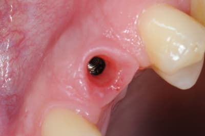 Dsc 5355 ap44db - Eugenol