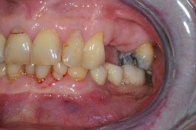 Dsc 5495 ofgj0q - Eugenol