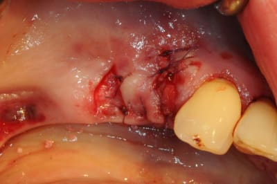 Dsc 5508 ujk46x - Eugenol