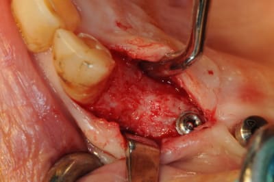 Dsc 5536 mshlhb - Eugenol