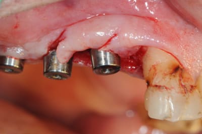 Dsc 5543 fznoez - Eugenol