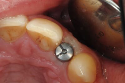 Dsc 5558 dykaxt - Eugenol