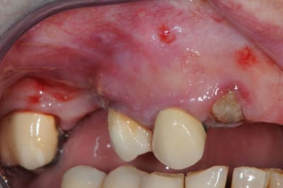 Dsc 5606 xmahcf - Eugenol