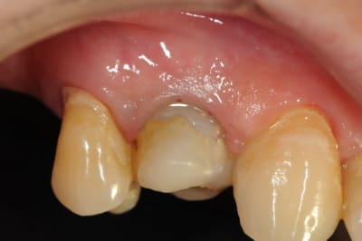 Dsc 5610 hcsqri - Eugenol