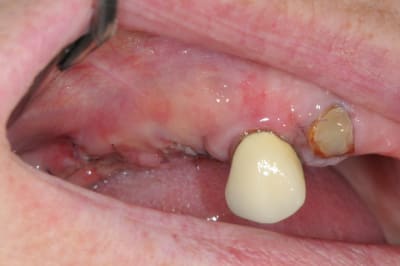 Dsc 5663 swvyx4 - Eugenol
