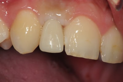 Dsc 5692 vnaw4w - Eugenol