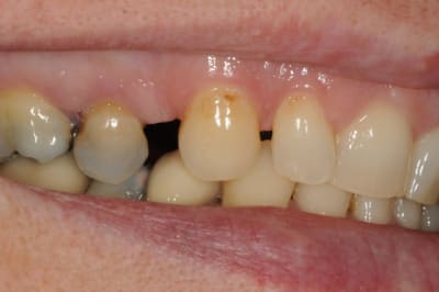 Dsc 5844 fqbzqb - Eugenol