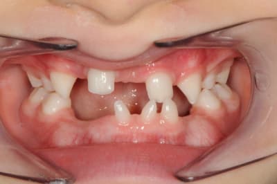 Dsc 5870 l50nuz - Eugenol