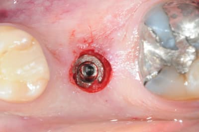 Dsc 5898 gzoayj - Eugenol