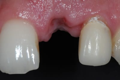 Dsc 5950 wakvmm - Eugenol
