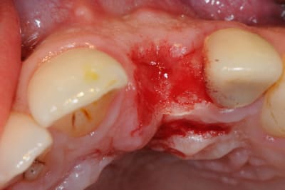 Dsc 5975 kbvdwt - Eugenol