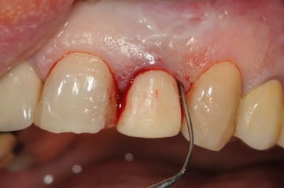 Dsc 5986 su7ril - Eugenol