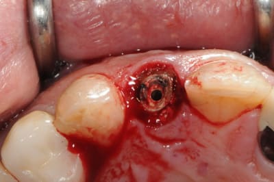 Dsc 5988 csmgs7 - Eugenol