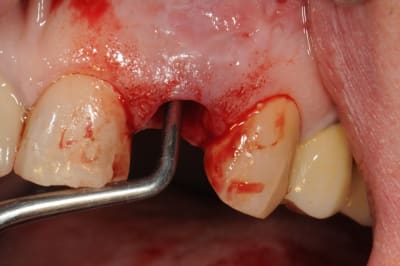 Dsc 5990 guz7vr - Eugenol