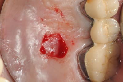 Dsc 6000 amfrcr - Eugenol