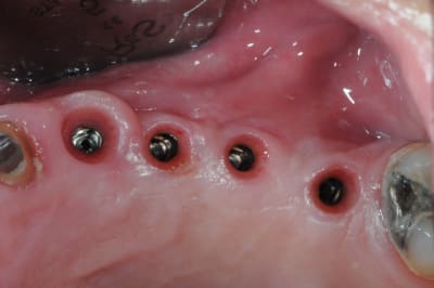 Dsc 6197 qrdxe5 - Eugenol