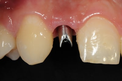 Dsc 6255 bdo2xc - Eugenol