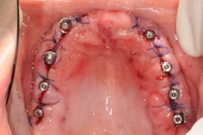 Dsc 6346 tb3xyc - Eugenol