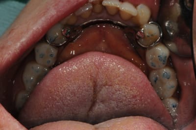 Dsc 6377 ifxwsl - Eugenol
