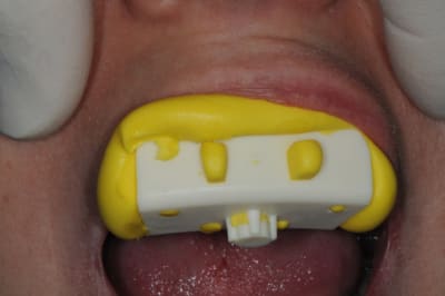 Dsc 6453 l2pwdw - Eugenol