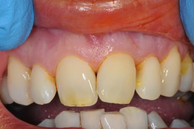 Dsc 6464 a8y81b - Eugenol