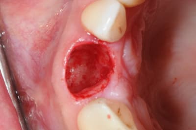 Dsc 6473 nnzu8m - Eugenol