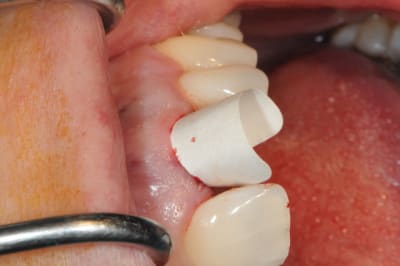 Dsc 6488 zfkqx0 - Eugenol