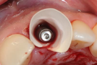 Dsc 6490 mph6r5 - Eugenol