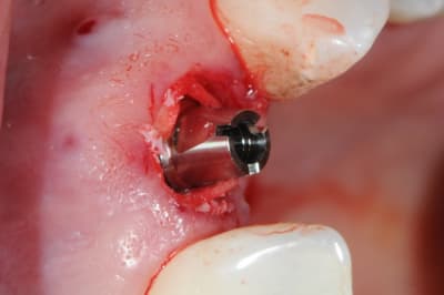 Dsc 6492 tt0atn - Eugenol