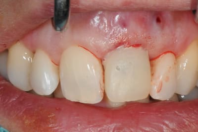 Dsc 6493 ip60jw - Eugenol