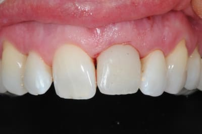 Dsc 6501 okis7q - Eugenol