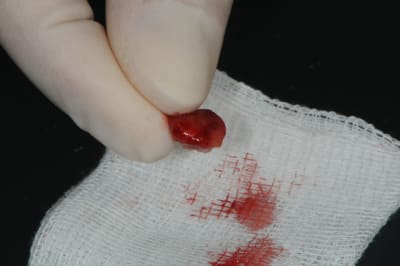 Dsc 6761 ekz9zb - Eugenol